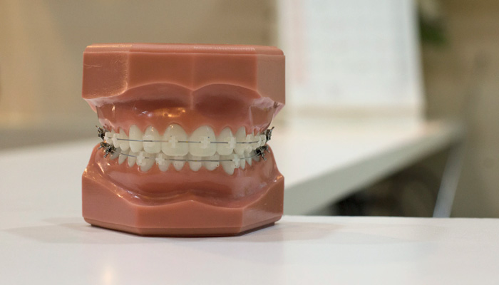 TRUCO LIMPIEZA FÉRULA DENTAL  Esta es la forma en la que puedes limpiar tu férula  dental y dejarla como nueva