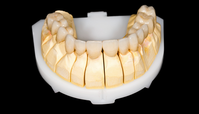 CAD/CAM dental dentadura
