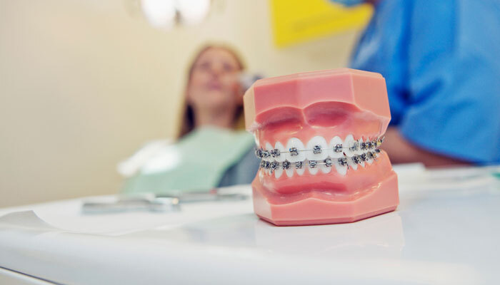 materiales de ortodoncia y sus funciones