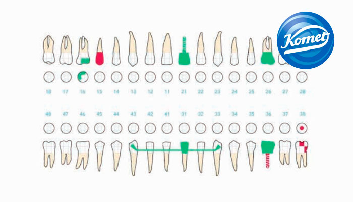 ¿En qué consiste un odontograma dental?