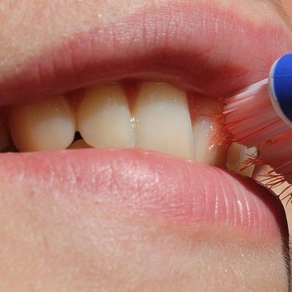 Cómo fortalecer un diente que se mueve