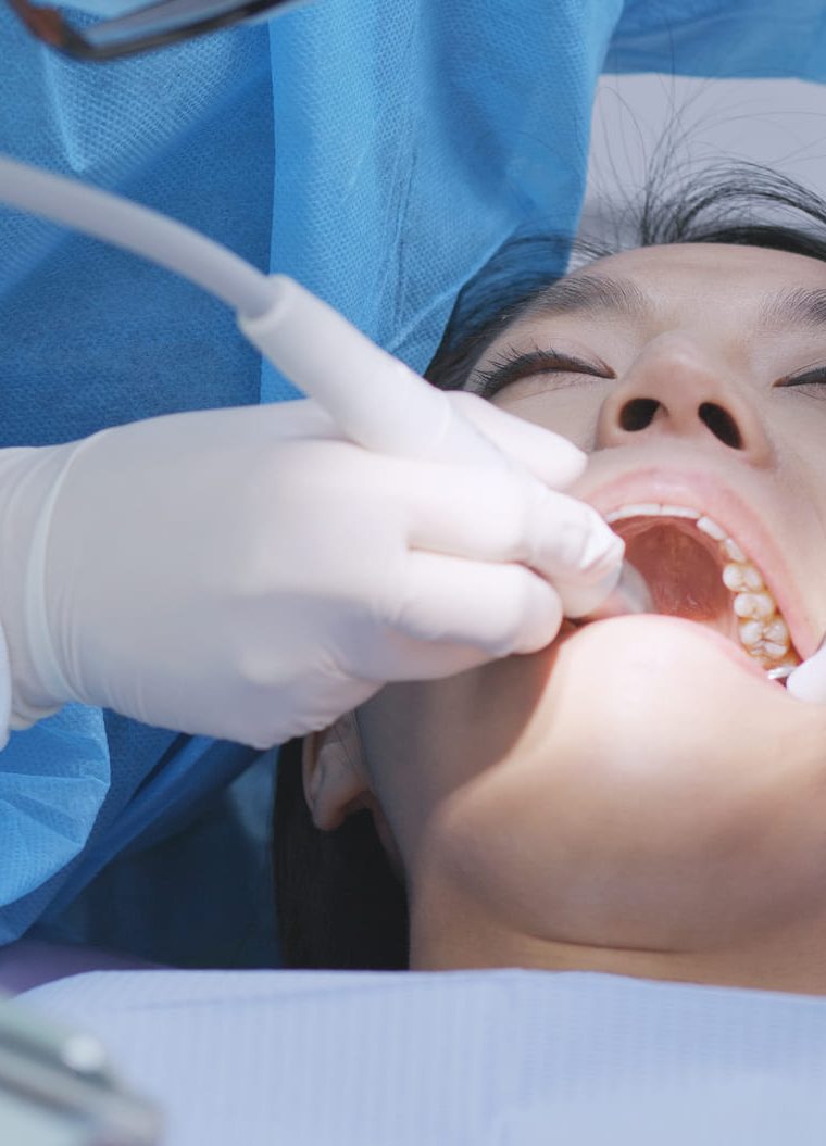 ¿Cómo se hace una limpieza dental en el dentista?