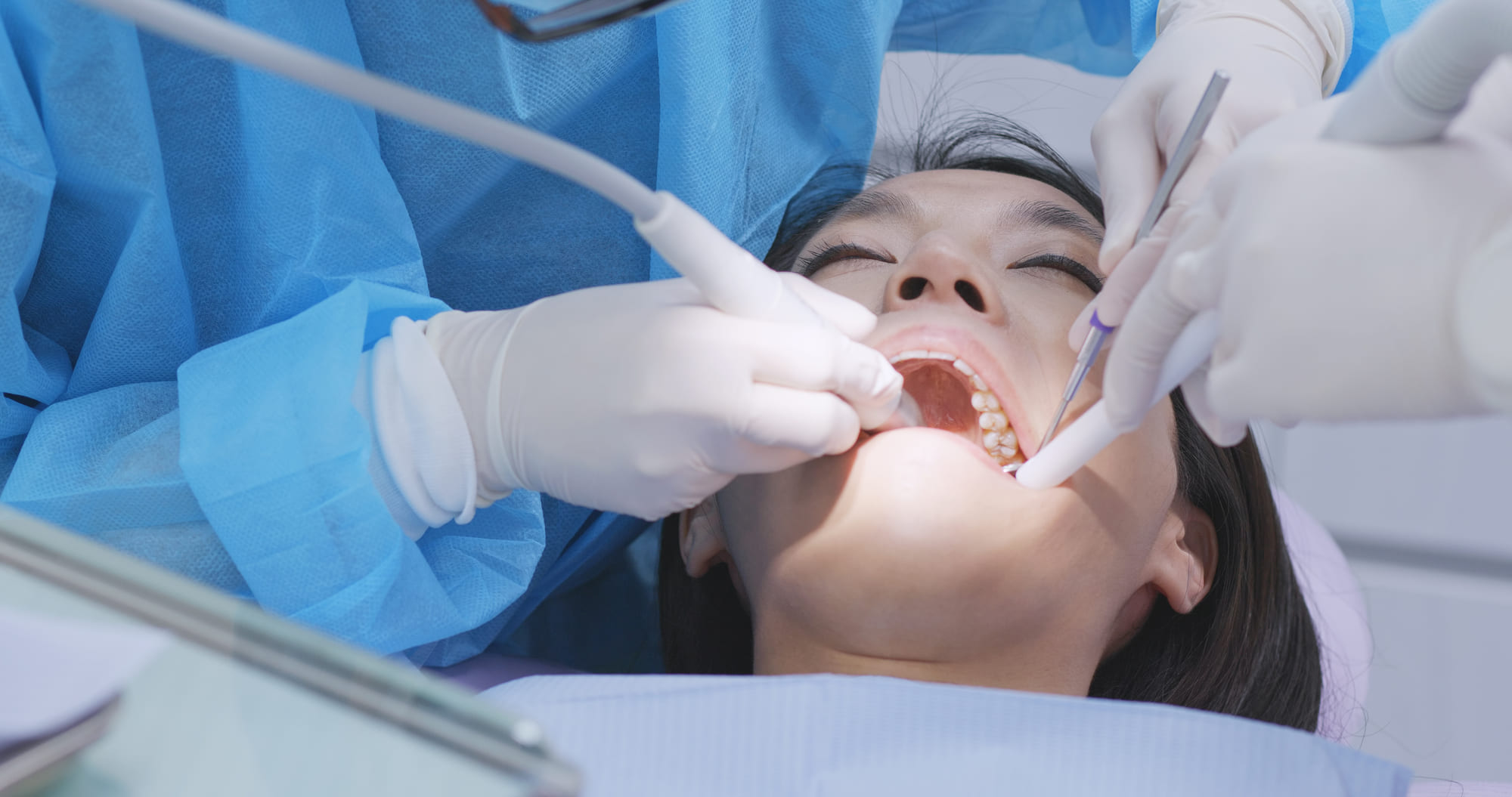 ¿Cómo se hace una limpieza dental en el dentista?