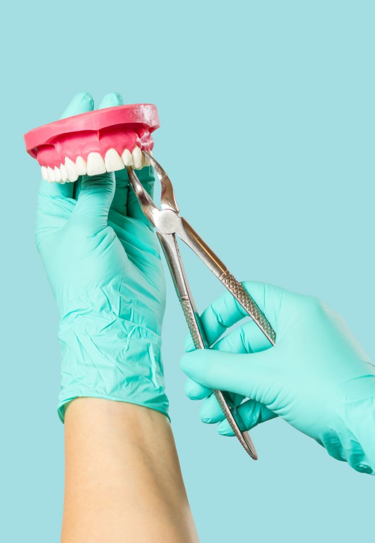 Alicate de How: Un instrumento esencial para la odontología