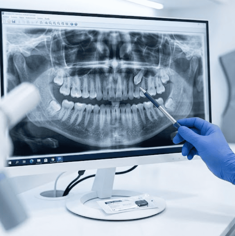 Radiografía oclusal: cómo se toma y para qué sirve